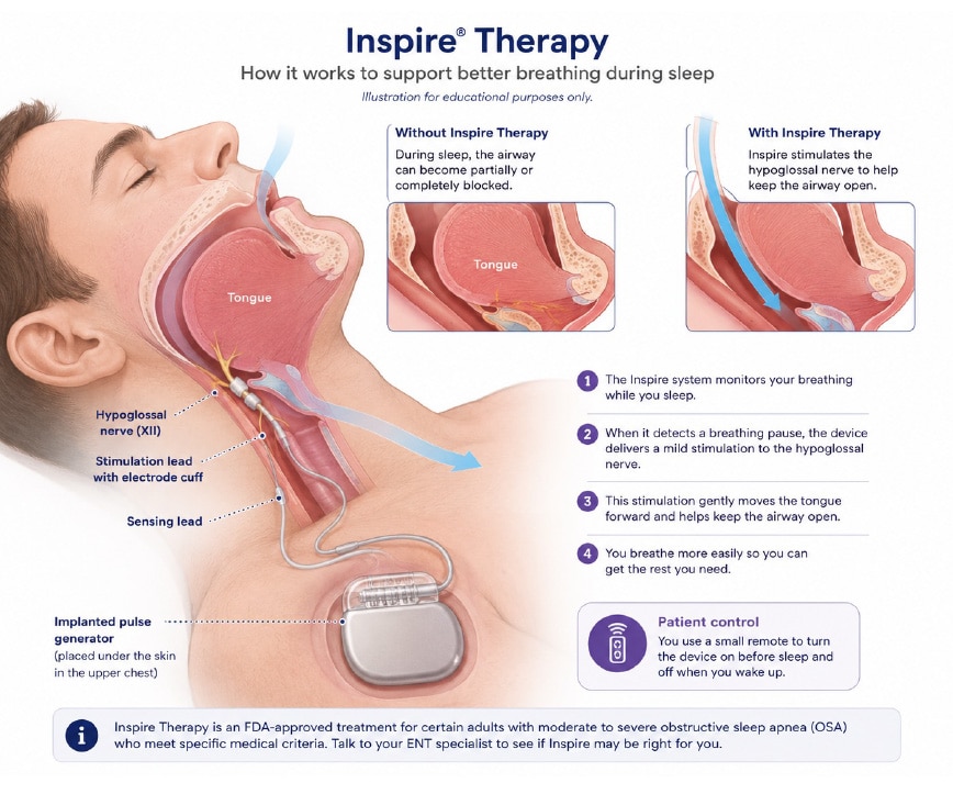 Inspire Therapy in Foley, AL