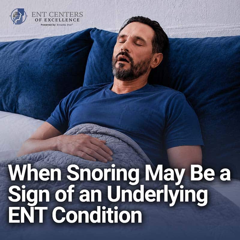 When Snoring Is More When Snoring Is More